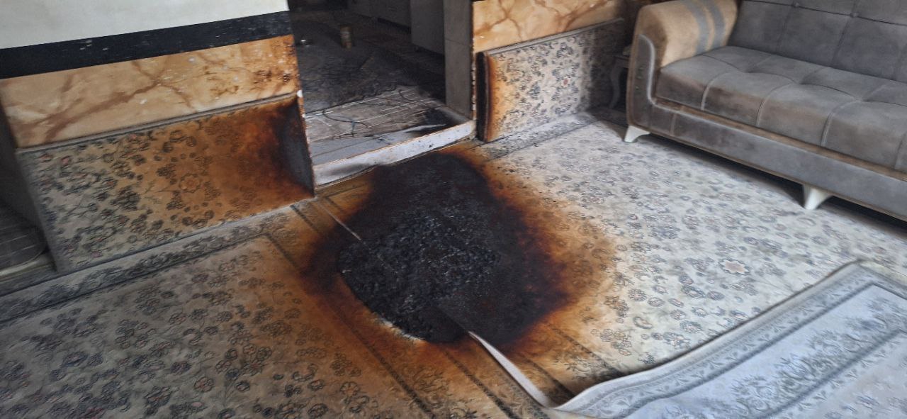 یک خانم در مریوان دچار سوختگی شد